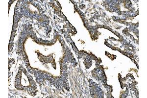 IHC analysis of KIF2A using anti-KIF2A antibody (ABIN7600510). (KIF2A anticorps  (AA 2-706))
