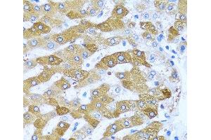 Immunohistochemistry of paraffin-embedded Human liver using IFIT3 Polyclonal Antibody at dilution of 1:100 (40x lens). (IFIT3 anticorps)