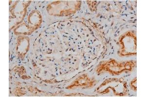 ABIN6267400 at 1/200 staining Human kidney tissue sections by IHC-P. (CREB1 anticorps  (pSer133))