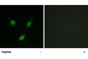 Immunofluorescence analysis of MCF-7 cells, using TACC1 polyclonal antibody .