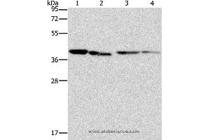 Western blot analysis of Human placenta tissue and NIH/3T3 cell, Raji and hepG2 cell, using BCAT2 Polyclonal Antibody at dilution of 1:312.