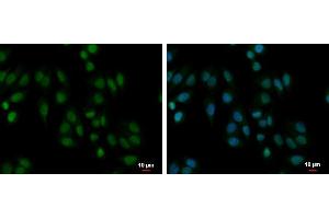 anti-Poly A Binding Protein Nuclear 1 (PABPN1) antibody