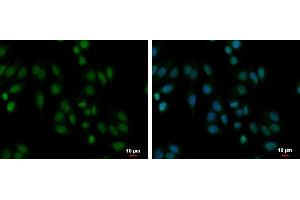 ICC/IF Image PABPN1 antibody detects PABPN1 protein at cytoplasm and nucleus by immunofluorescent analysis. (PABPN1 anticorps)