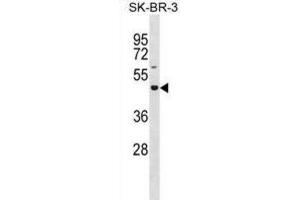 Western Blotting (WB) image for anti-Glucoside Xylosyltransferase 2 (GXYLT2) antibody (ABIN3001024)