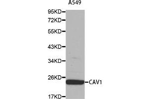 Western blot analysis of extracts of A-549 cells, using CAV1 antibody (ABIN5969989). (Caveolin-1 anticorps)
