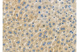 ABIN6262126 and ABIN6279461 at 1/100 staining Mouse liver tissue by IHC-P.