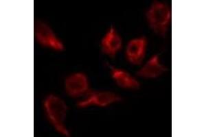 ABIN6269282 staining 293 by IF/ICC. (EFNB1/2 anticorps)