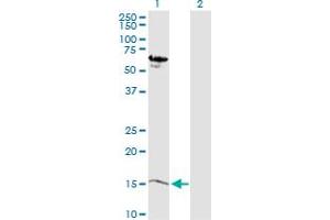 Western Blot analysis of MB expression in transfected 293T cell line by MB MaxPab polyclonal antibody.