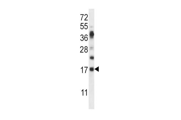 RNASE6 anticorps  (C-Term)