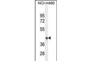 FX4L1 Antibody (N-term) (ABIN655284 and ABIN2844875) western blot analysis in NCI- cell line lysates (35 μg/lane). (FOXD4L1 anticorps  (N-Term))