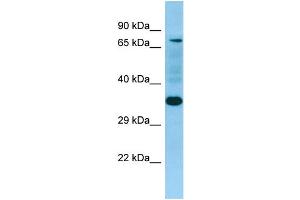 WB Suggested Anti-SELPLG Antibody Titration: 1. (SELPLG anticorps  (N-Term))