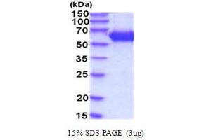 SDS-PAGE (SDS) image for Hexosaminidase A (HEXA) (AA 23-529) protein (His tag) (ABIN5854270)