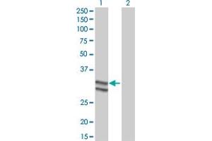 Western Blot analysis of SERPINC1 expression in transfected 293T cell line by SERPINC1 monoclonal antibody (M02), clone 2B12. (SERPINC1 anticorps  (AA 1-259))