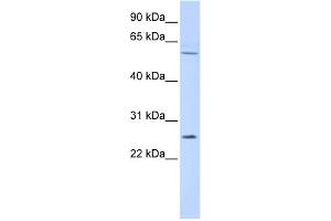 WB Suggested Anti-FAM124A Antibody Titration: 0. (FAM124A anticorps  (Middle Region))