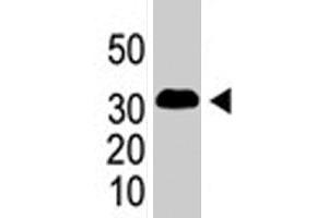 The SNAI1 polyclonal antibody  is used in Western blot to detect SNAI1 in SNAI1-293 cells (flag-tagged) . (SNAIL anticorps  (AA 9-39))