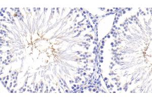 Detection of TNFa in Rat Testis Tissue using Polyclonal Antibody to Tumor Necrosis Factor Alpha (TNFa) (TNF alpha anticorps  (AA 80-235))