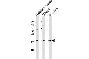 All lanes : Anti-SDHC Antibody (C-Term) at 1:2000 dilution Lane 1: human skeletal muscle lysate Lane 2: mouse heart lysate Lane 3: mouse kidney lysate Lysates/proteins at 20 μg per lane.