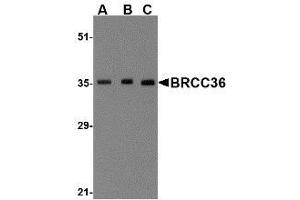 Western blot analysis of BRCC36 in MCF7 cell lysate with AP30164PU-N BRCC36 antibody at (A) 0. (BRCC3 anticorps  (N-Term))