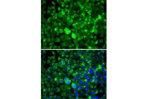 Immunofluorescence analysis of MCF7 cells using RPLP1 antibody (ABIN6129657, ABIN6147166, ABIN6147167 and ABIN6222445). (RPLP1 anticorps  (AA 1-114))