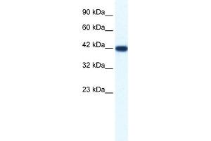 WB Suggested Anti-IBSP Antibody Titration:  1. (IBSP anticorps  (N-Term))