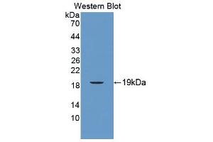 Figure. (CD160 anticorps  (AA 33-171))