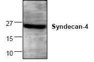 Image no. 1 for anti-Syndecan 4 (SDC4) antibody (ABIN127275) (SDC4 anticorps)
