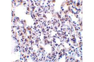 Immunohistochemistry of BCAP31 in rat lung tissue with BCAP31 polyclonal antibody  at 10 ug/mL . (BCAP31 anticorps  (Internal Region))