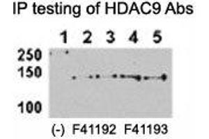 HDAC9 antibody NSJ# F41192 and NSJ# F41193 can both immunoprecipitate the protein from HeLa-HDAC9 tranfected cells. (HDAC9 anticorps  (AA 2-32))