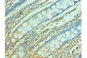 Immunohistochemistry of paraffin-embedded human colon tissue using ABIN7153122 at dilution of 1:100