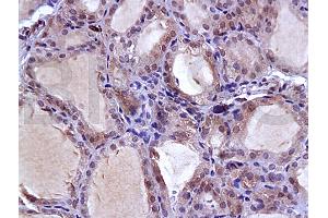 Formalin-fixed and paraffin embedded rat thyroid gland labeled with Anti-NIS Polyclonal Antibody, Unconjugated (ABIN668751) at 1:200, followed by conjugation to the secondary antibody and DAB staining