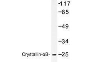 Western blot analysis of Crystallin-αB antibody in extracts from mouse lung cells. (CRYAB anticorps)