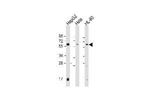 Western Blot at 1:2000 dilution Lane 1: HepG2 whole cell lysate Lane 2: Hela whole cell lysate Lane 3: HL-60 whole cell lysate Lysates/proteins at 20 ug per lane. (PI4K2A anticorps  (C-Term))