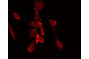 ABIN6275145 staining COLO205 cells by IF/ICC. (GCP6 anticorps  (Internal Region))
