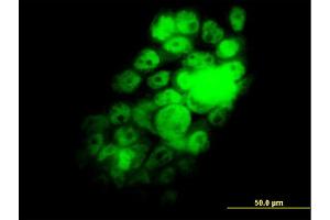 Immunofluorescence of monoclonal antibody to RBM9 on A-431 cell. (RBM9 anticorps  (AA 1-100))