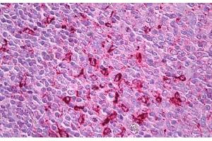 Anti-Cathepsin S antibody IHC staining of human tonsil. (Cathepsin S anticorps)