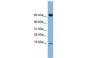 WB Suggested Anti-CRIP1 Antibody Titration:  0. (CRIP1 anticorps  (N-Term))