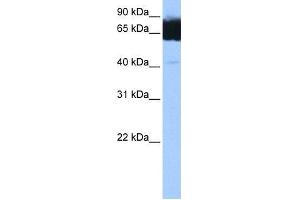 Image no. 1 for anti-Tetratricopeptide Repeat Domain 12 (TTC12) (C-Term) antibody (ABIN631929) (TTC12 anticorps  (C-Term))