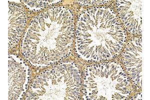 ABIN7095632 and ABIN7099694 at 1/100 staining rat testis tissue by IHC-P.