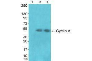 Western blot analysis of extracts from JK cells (Lane 2) and cos-7 cells (Lane 3), using Cyclin A antiobdy. (Cyclin A1 anticorps)