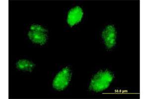 Immunofluorescence of purified MaxPab antibody to ETV7 on Daoy cell. (ETV7 anticorps  (AA 1-341))