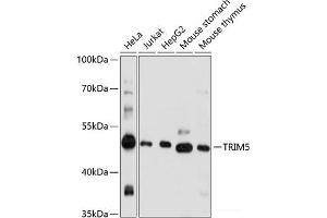 Western blot analysis of extracts of various cell lines using TRIM5 Polyclonal Antibody at dilution of 1:1000. (TRIM5 anticorps)