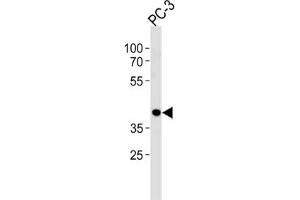 Western Blotting (WB) image for anti-CAMP Responsive Element Binding Protein 3-Like 4 (CREB3L4) antibody (ABIN2998939) (CREB3L4 anticorps)