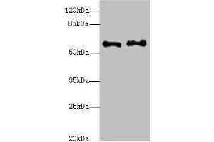 Western blot All lanes: NMT2 antibody at 4. (NMT2 anticorps  (AA 1-120))