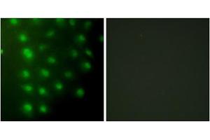 Immunofluorescence analysis of HUVEC cells, using AKAP8 antibody. (AKAP8 anticorps  (Internal Region))
