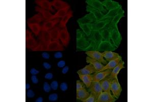 ABIN7094065 and ABIN7098109 staining Hela cells(24h of starvation treatment) by IF/ICC. (AP2B1 anticorps  (N-Term))