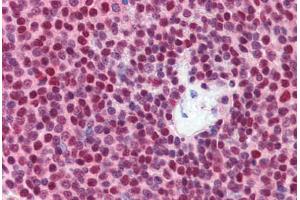 Human Spleen (formalin-fixed, paraffin-embedded) stained with NKRF antibody ABIN462215 followed by biotinylated goat anti-rabbit IgG secondary antibody ABIN481713, alkaline phosphatase-streptavidin and chromogen.