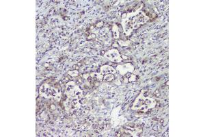 IHC analysis of MPI using anti-MPI antibody (ABIN4886672). (MPI anticorps  (AA 2-99))