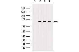Western blot analysis of extracts from various samples, using ETFDH Antibody. (ETFDH anticorps  (C-Term))