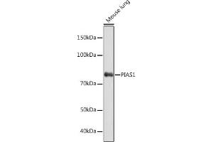 Western blot analysis of extracts of Mouse lung, using PI Rabbit mAb (ABIN7269622) at 1:1000 dilution. (PIAS1 anticorps)