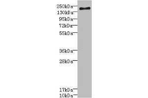 Western blot All lanes: SCN7A antibody at 2.